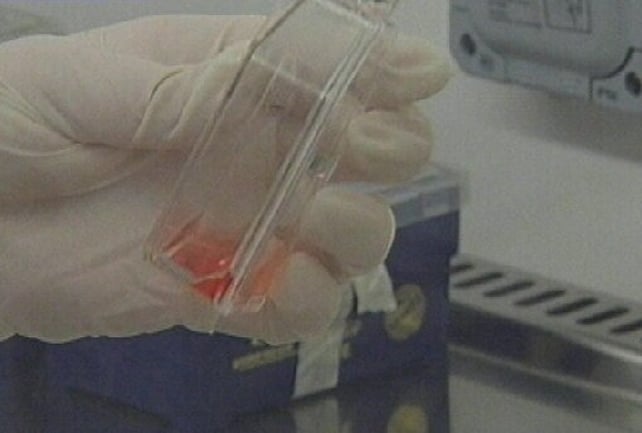 Irish genetics - TCD team leads project Irish genetics - TCD team leads project