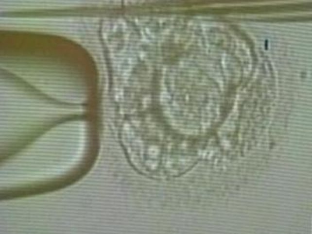 Embryo - Ethical questions over resarch Embryo - Ethical questions over resarch