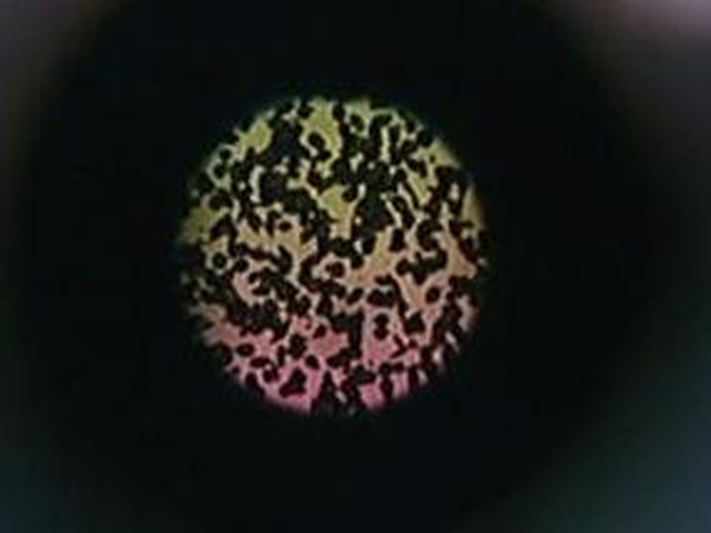Radon - People urged to test for radioactive gas Radon - People urged to test for radioactive gas