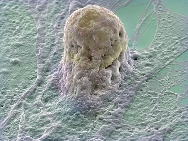 Stem cells - May have potential for various medical uses Stem cells - May have potential for various medical uses