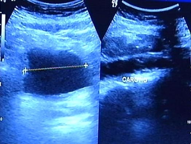 Image diagnostic - Improved tests for cancer Image diagnostic - Improved tests for cancer