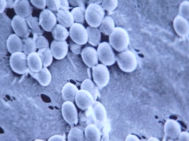 Swine flu - 4 people have died from the virus in Ireland Swine flu - 4 people have died from the virus in Ireland
