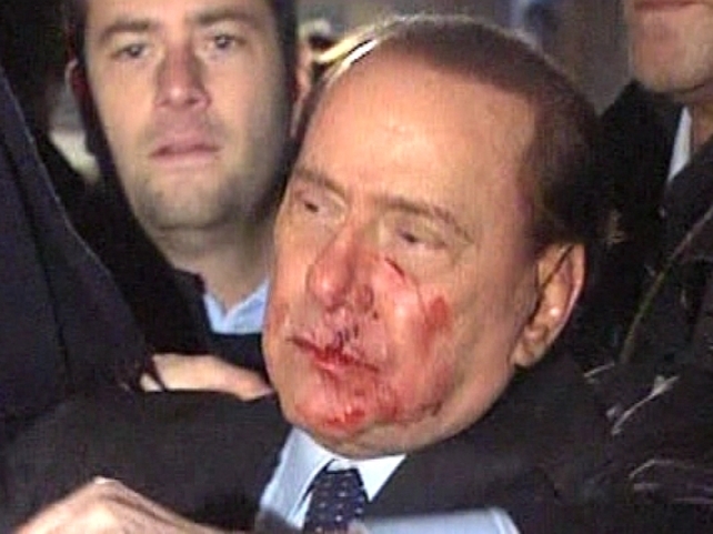 Silvio Berlusconi - Attacked last week Silvio Berlusconi - Attacked last week