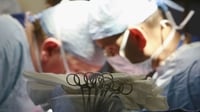 Decrease in number of organ donors Decrease in number of organ donors