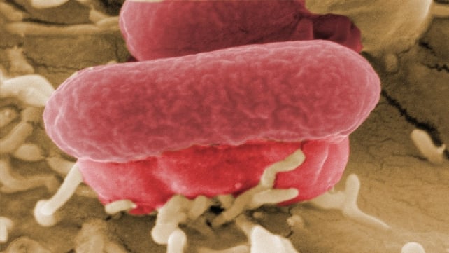 E coli is described as the worst ever seen in Northern Ireland E coli is described as the worst ever seen in Northern Ireland