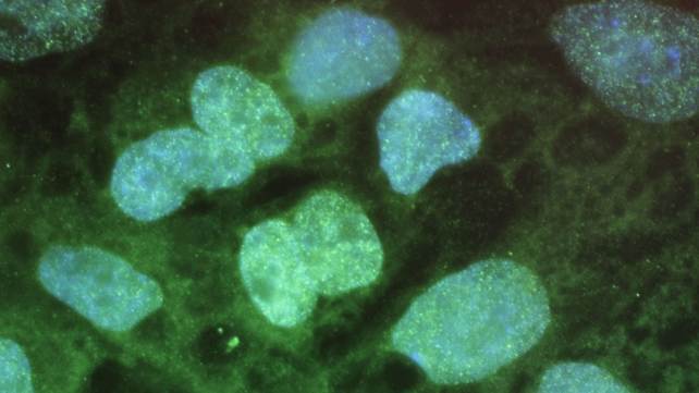 The results mean researchers might eventually be able to reprogramme patients' cells to repair their own damaged hearts The results mean researchers might eventually be able to reprogramme patients' cells to repair their own damaged hearts