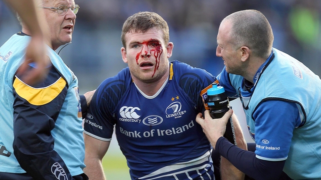 Gordon D'Arcy required stitches following this injury sustained against Glasgow Warriors