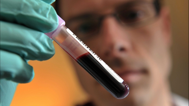 There were only 131 blood tests carried out in professional tennis in 2011