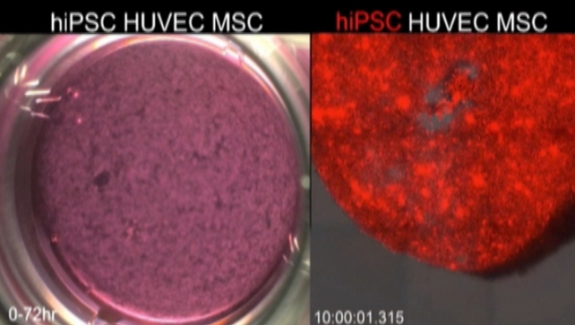 Stem cells were combined with two other cell types required for the development of the human liver Stem cells were combined with two other cell types required for the development of the human liver