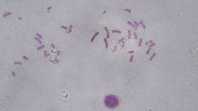 Recent years have seen huge advances in chromosomal therapy Recent years have seen huge advances in chromosomal therapy