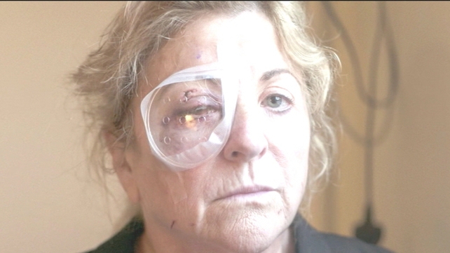 Marie Gauvin was on holidays when she was struck and sustained serious eye injuries Marie Gauvin was on holidays when she was struck and sustained serious eye injuries
