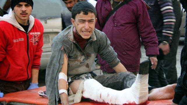 An injured Syrian youth cries as he is carried on a gurney following an airstrike in the Maadi neighbourhood of the northern Syrian city of Aleppo An injured Syrian youth cries as he is carried on a gurney following an airstrike in the Maadi neighbourhood of the northern Syrian city of Aleppo
