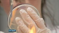 Six One News: Scientists find evidence of soaring levels of MRSA Six One News: Scientists find evidence of soaring levels of MRSA