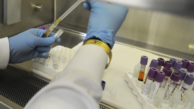 This is the second case of a newborn where doctors may have brought HIV into remission This is the second case of a newborn where doctors may have brought HIV into remission