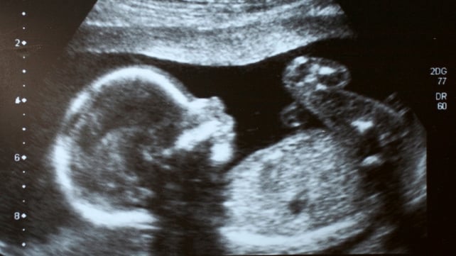 Obstetricians, trainees and midwives will get the new guidelines today Obstetricians, trainees and midwives will get the new guidelines today