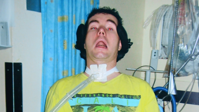 David Garvey has been in Beaumont Hospital for 15 months David Garvey has been in Beaumont Hospital for 15 months