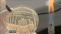 One News: New virulent form of MRSA in Irish hospitals One News: New virulent form of MRSA in Irish hospitals