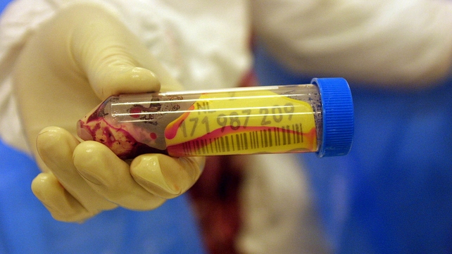 A second case of atypical mad cow disease has been found in Brazil A second case of atypical mad cow disease has been found in Brazil