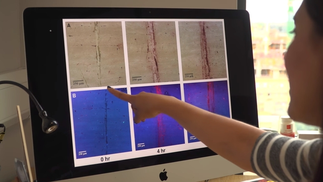 The research could lead to the development of a method for diagnosing problems with bone strength