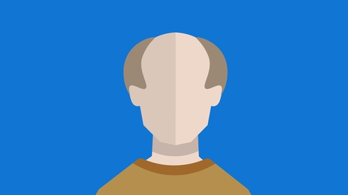 Have scientists just found a cure for baldness? Have scientists just found a cure for baldness?