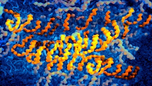Rare Genetic Mutation Makes Woman Feel Almost No Pain, Researchers Find Rare Genetic Mutation Makes Woman Feel Almost No Pain, Researchers Find