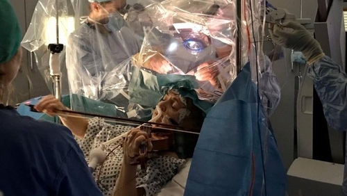 Patient plays violin during brain operation Patient plays violin during brain operation