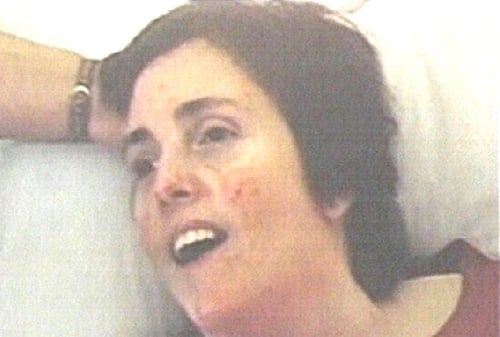 Terri Schiavo - Dies 13 days after tube removal