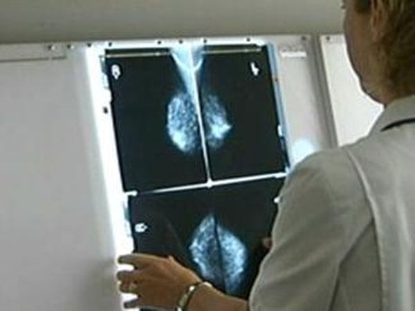 Breast screening - Group wants age limit lowered