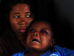 A young Haitian earthquake survivor is comforted by her older sister during a medical evacuation aboard a US Navy vessel