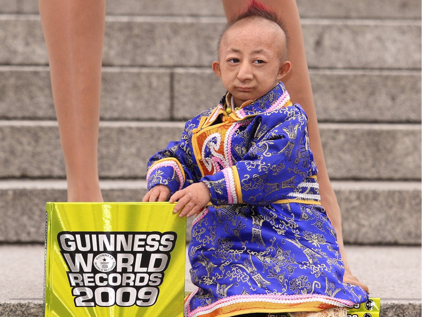 World's shortest man dies aged 21