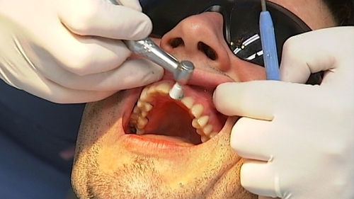 Dentists - Medical card funds at 2008 levels