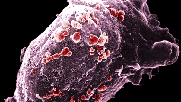 HIV virus recurs in child who was thought to be cured