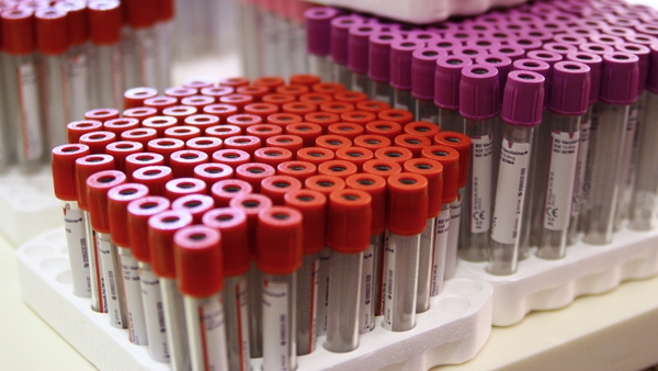 The new blood test analyses the changes in concentration of a small molecule called microRNA