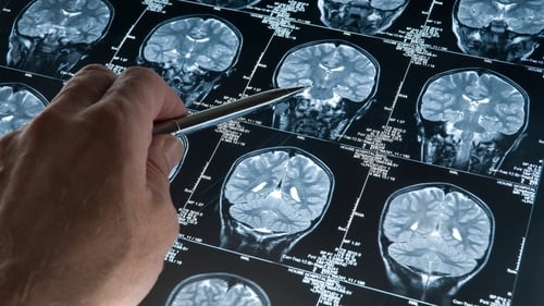 The study found microbiota can impact small molecules that influence how genes are expressed in the brain