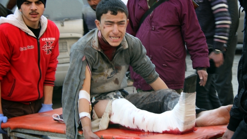An injured Syrian youth cries as he is carried on a stretcher following an airstrike in the Maadi area of Aleppo