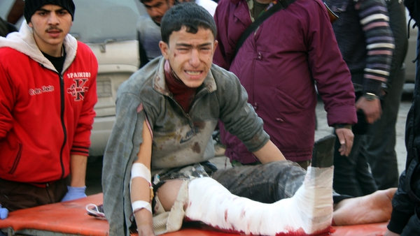 An injured Syrian youth cries as he is carried on a gurney following an airstrike in the Maadi neighbourhood of the northern Syrian city of Aleppo
