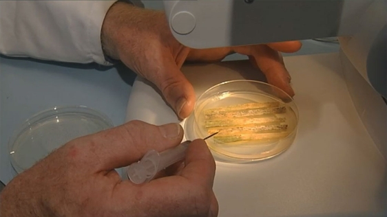 Ireland's First Case of Swine Flu