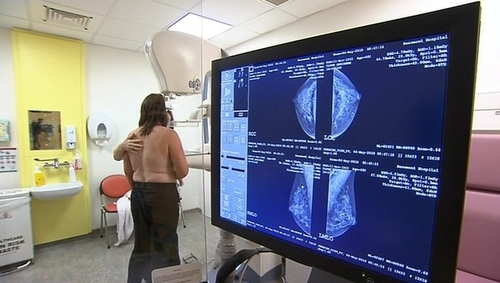 Until now there has been no reliable way of predicting the likelihood of non-inherited breast cancer