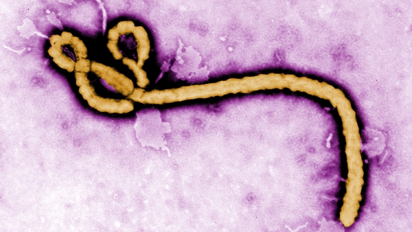 Fever, vomiting and severe diarrhoea are among the symptoms of Ebola