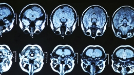 Prime Time Extras: Brain Injury Funding