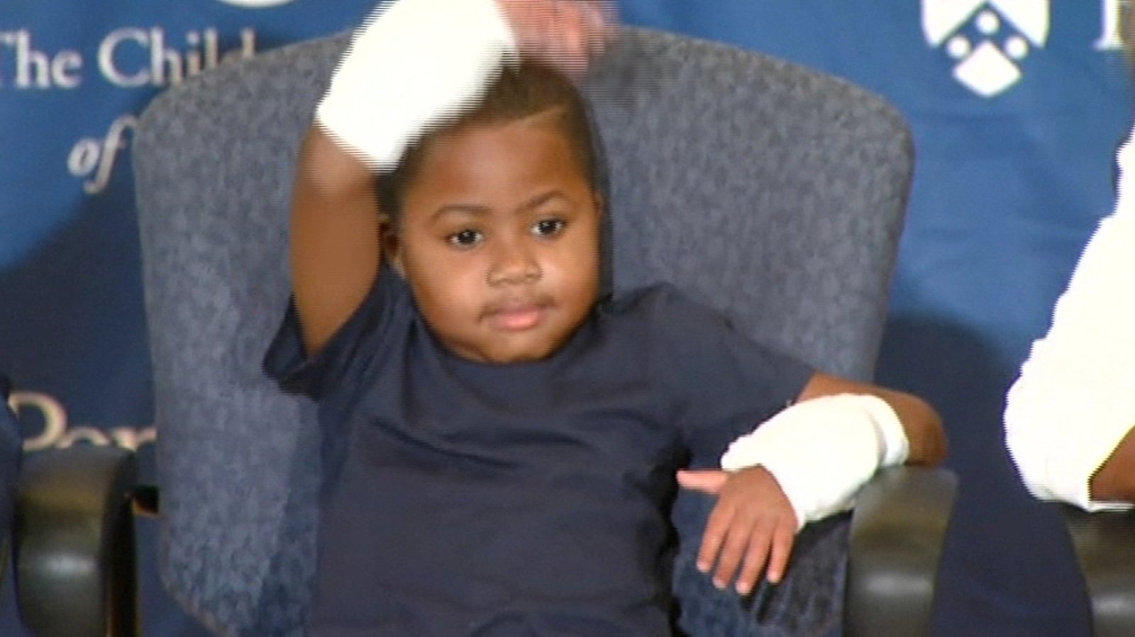US boy receives double hand transplant
