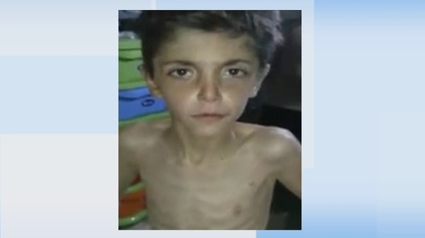 Amateur video uploaded to the internet shows an emaciated young boy from the Syrian town of Madaya