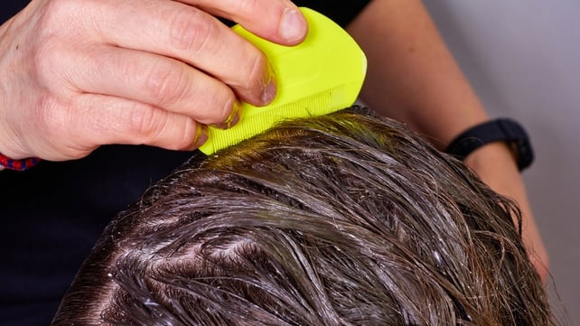 The best treatment is the age-old combing through hair - wet or dry