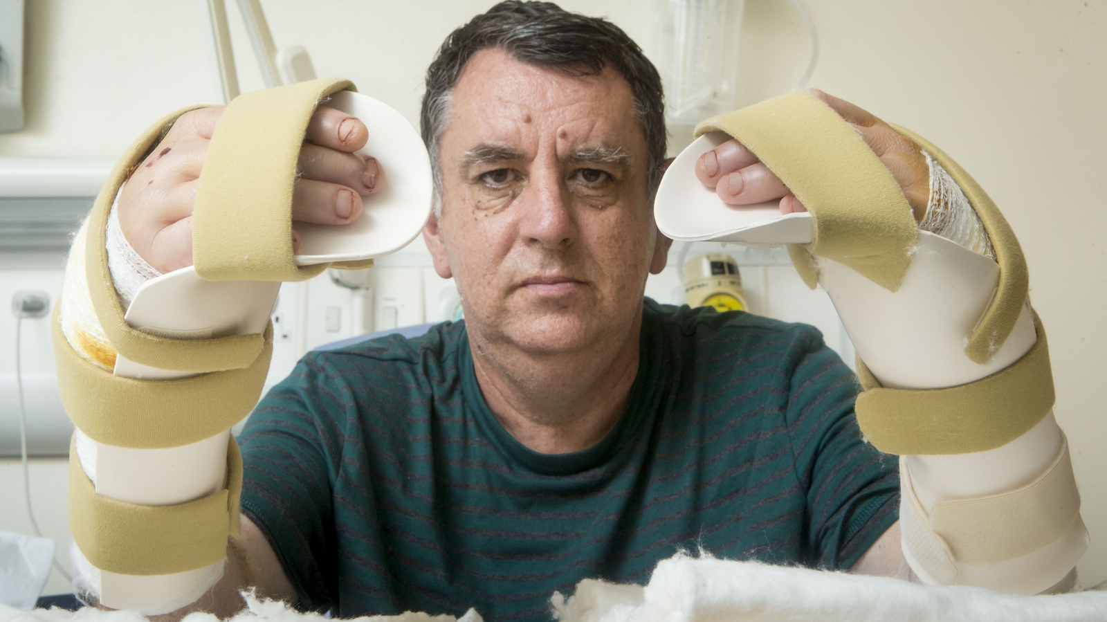 Hand transplant patient feels 'whole again'