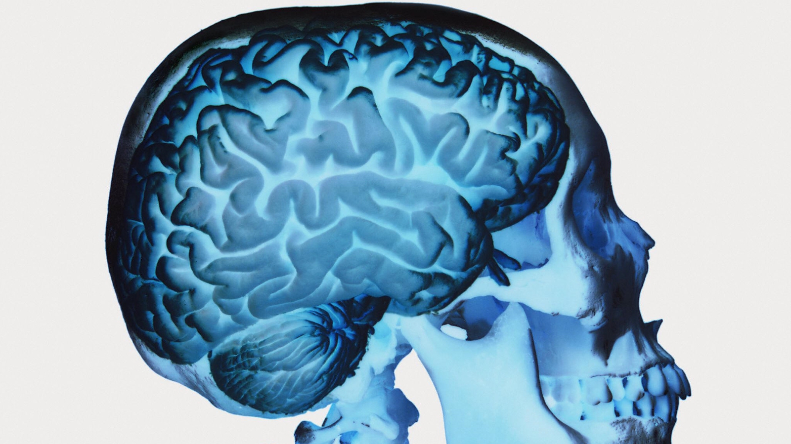 Мозг терапи отзывы покупателей и врачей. Синий мозг. Исследование головного мозга. Американ бойс головного мозга.