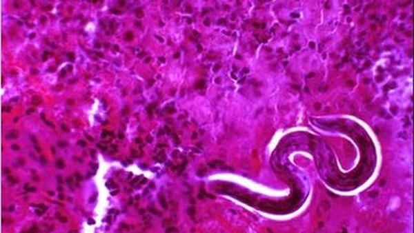 The parasite claims around 60,000 lives around the world every year (Pic: Dr Christina Dold and Prof Celia Holland)