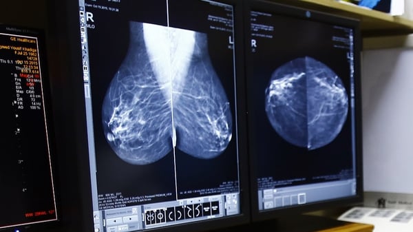 The new drug called THZ-1 is capable of halting the growth of triple negative breast cancer