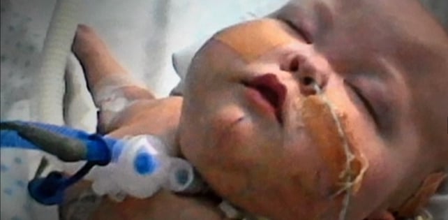 Liam McEntee as a young baby Liam McEntee as a young baby