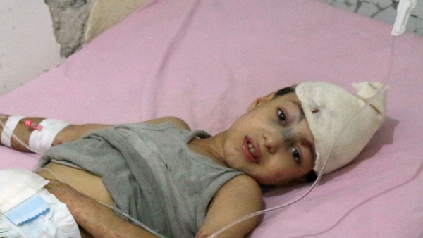 A young Syrian boy receives treatment at a hospital in the regime-held part of Aleppo