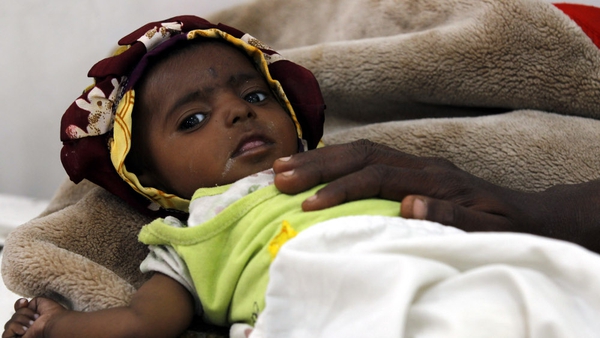 A malnourished child receives treatment at a hospital in Sanaa